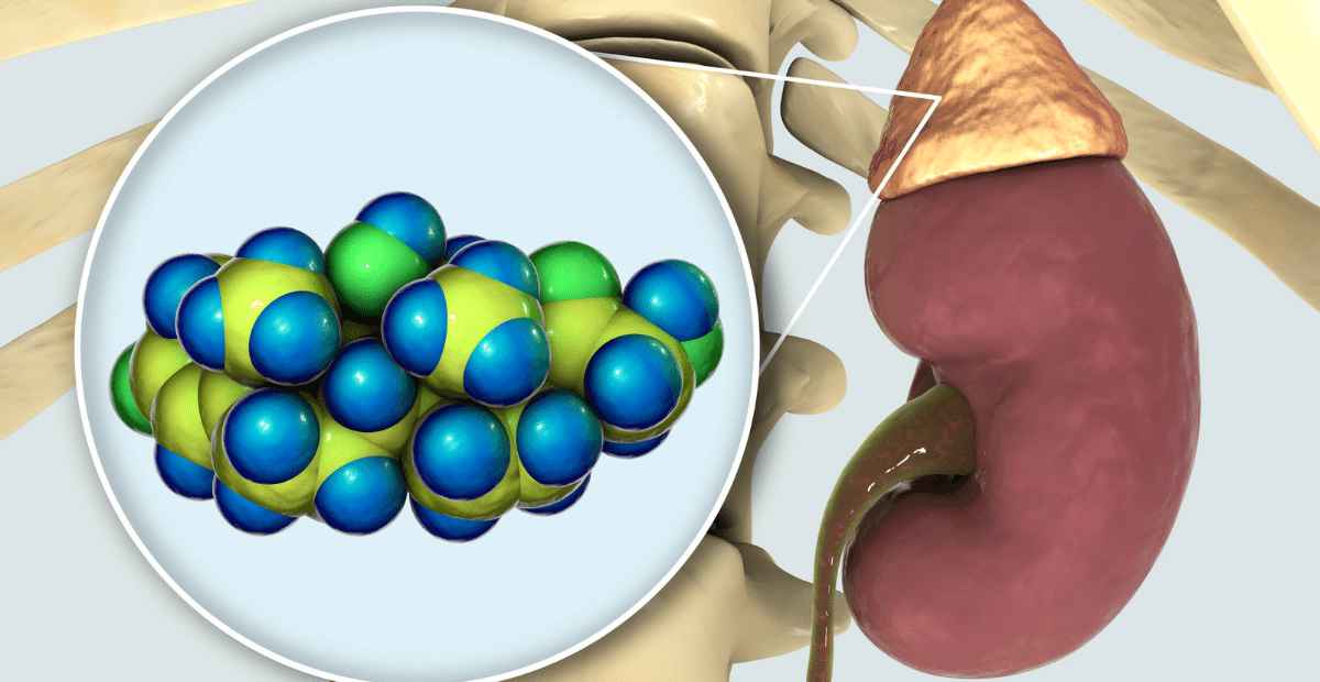 adrenal pcos